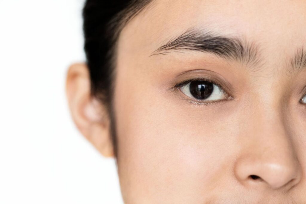 Polynucleotide vs Hyaluronic Acid Fillers