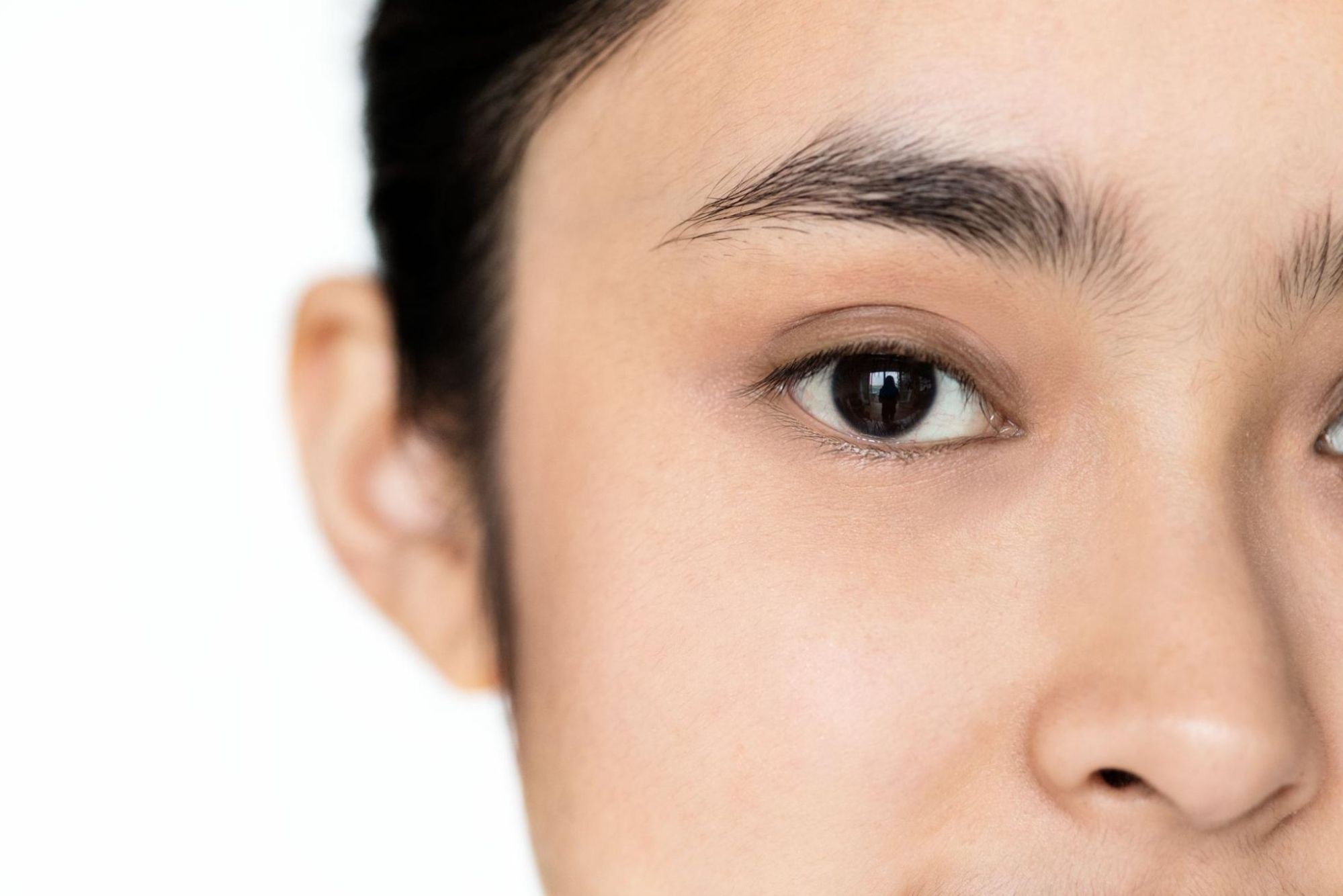 Polynucleotide vs Hyaluronic Acid Fillers